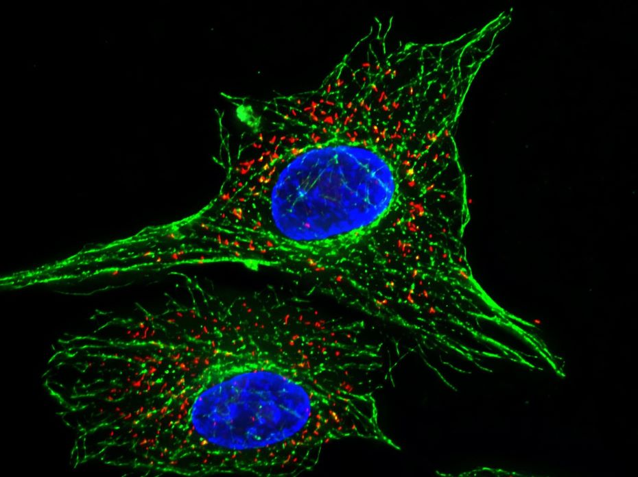 csm_Fluorescently-labelled-cell_69e5ffd197.jpg